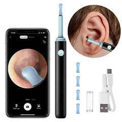 Smart Ear Wax Cleaner with HD Camera, LED Light & Wireless Otoscope | High-Precision Ear Cleaning Kit